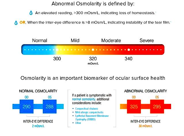 Abnormal osmolarity chart